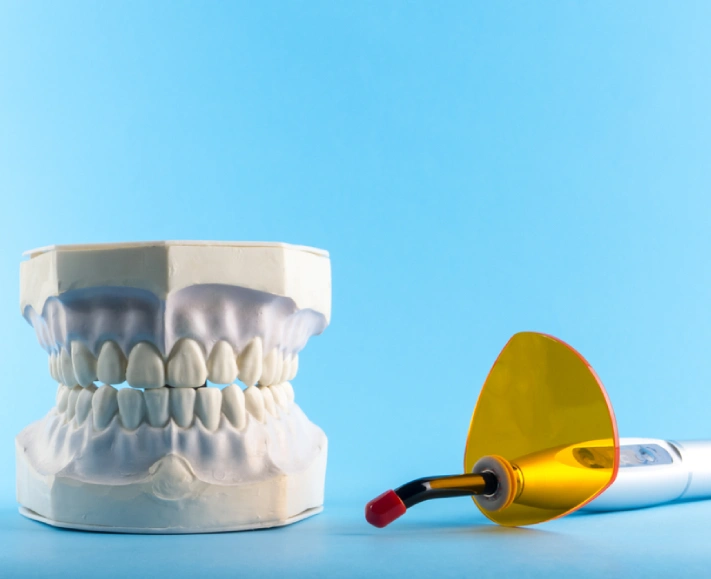 Laser dentist in Andheri West